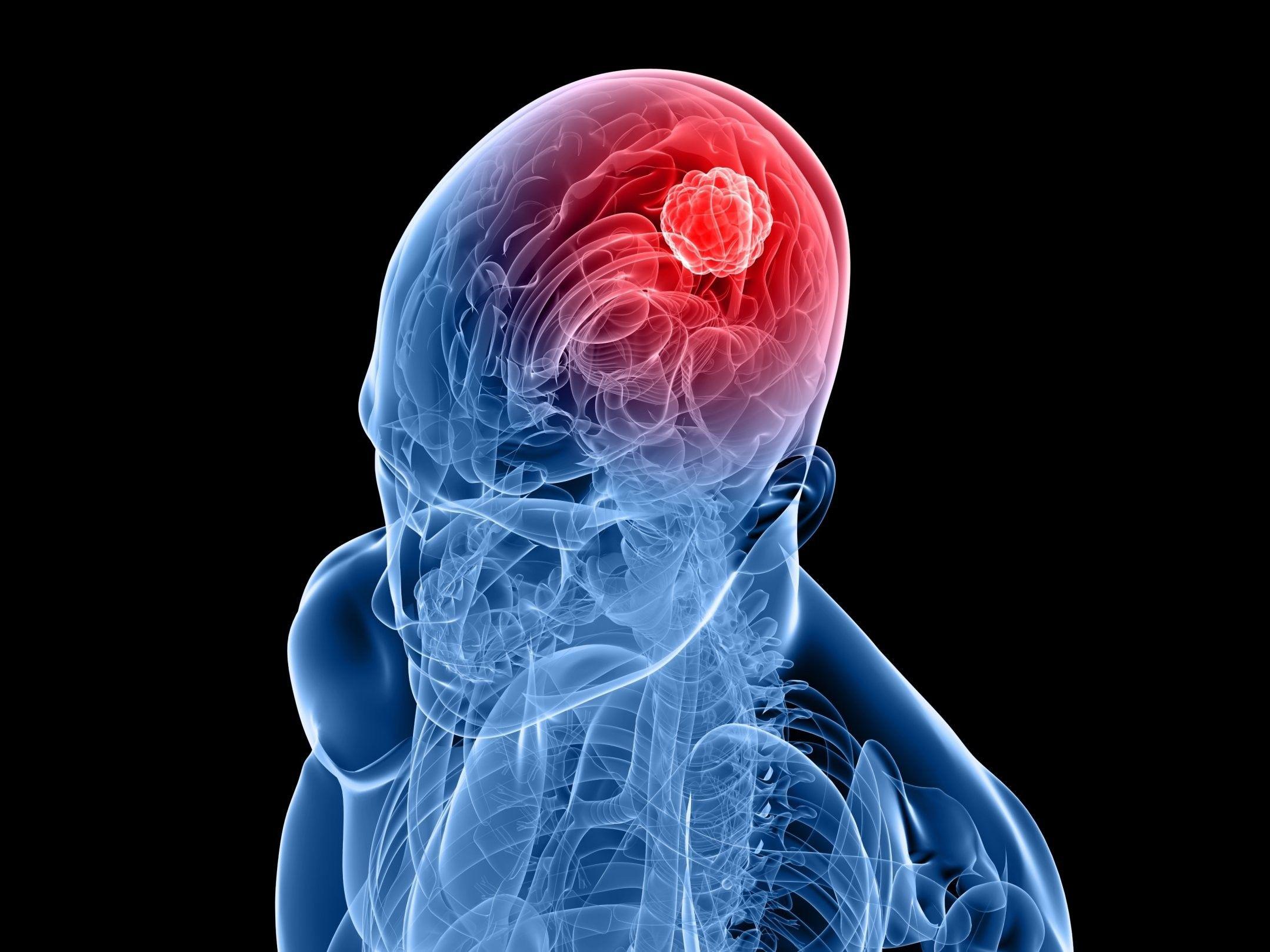 2159x1619 Minimalism Black Background People Brain X Rays Face Digital Art Bones Blue Red Wallpaper:2159x1619