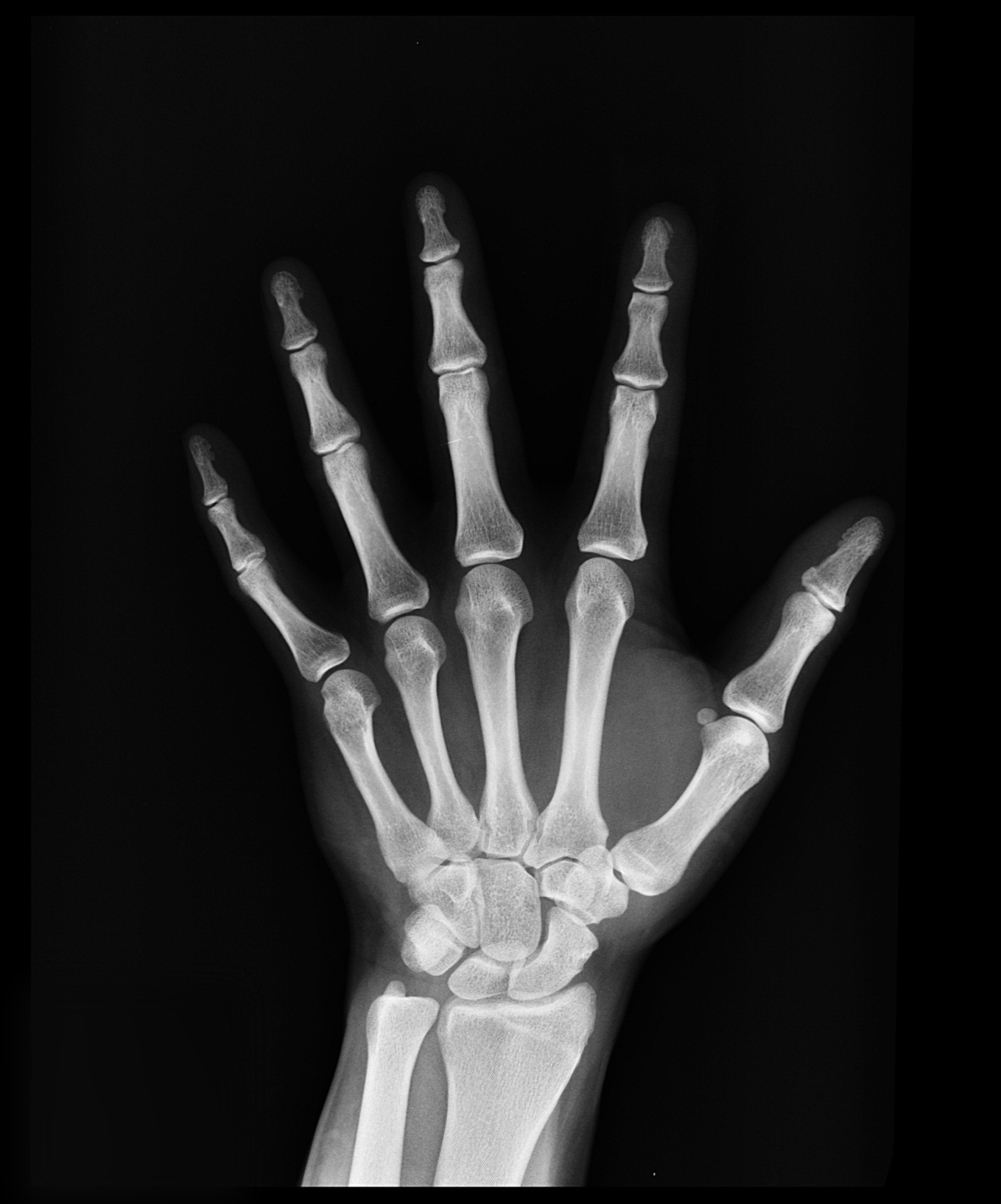 5967x7175 Hand X Ray Result · Free