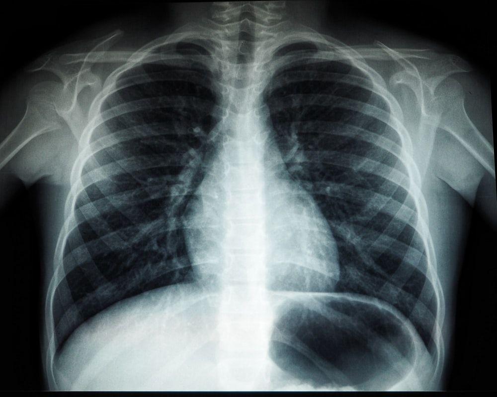 1000x800 X Ray Picture. Download Free Image