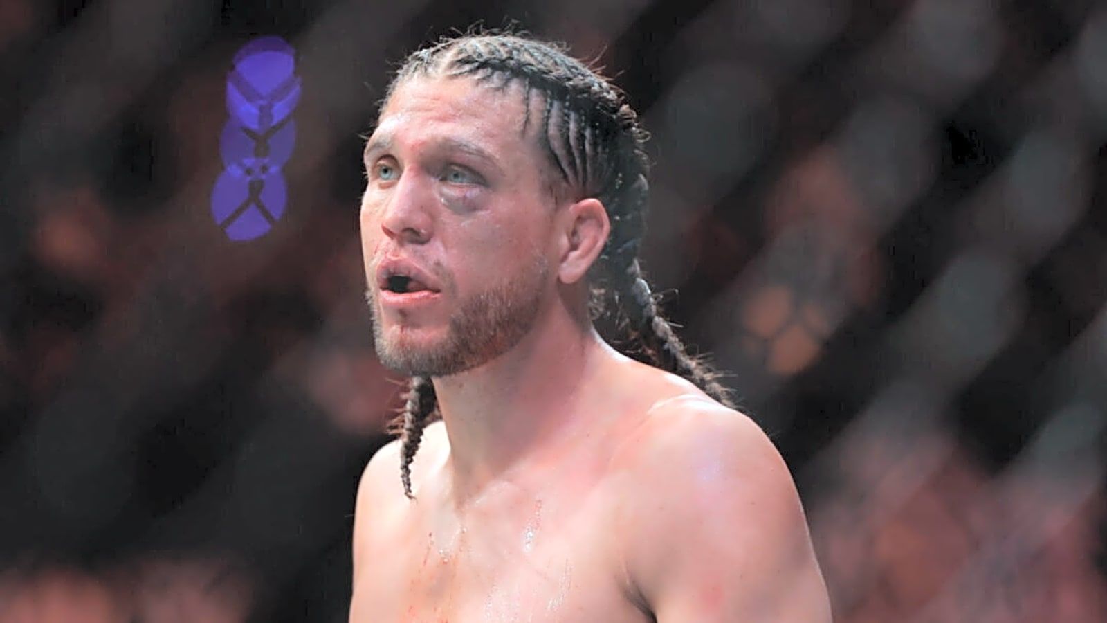1600x900 Injury Forces Renato Moicano vs. Brian Ortega Fight Cancellation Days Before UFC 331