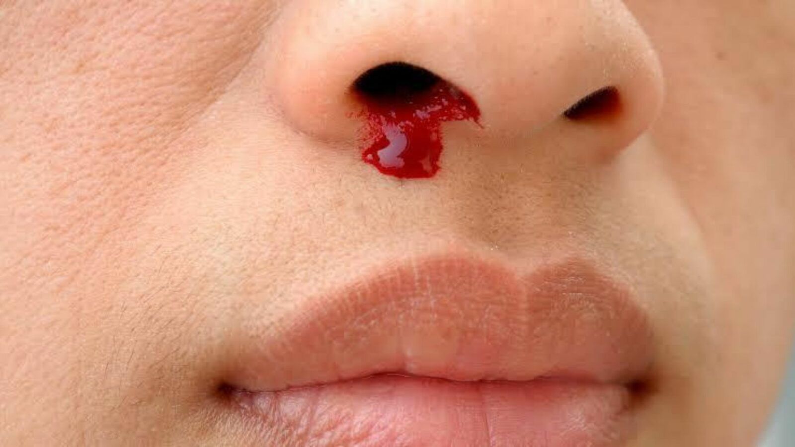 1600x900 Bloody hell: How to manage unsettling nosebleeds For Mzansi