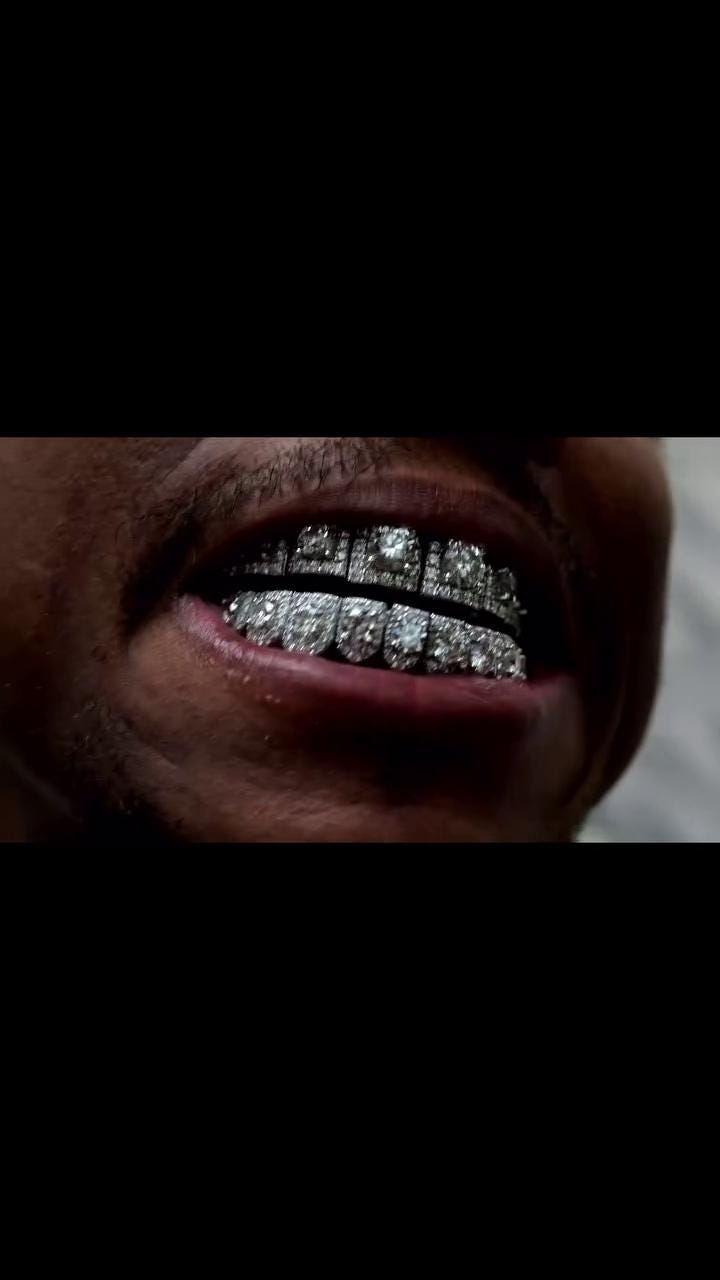 720x1280 Solitaire Halo Set VVS Moissanite Perm Cut Grillz 925 Sterling Silver, Pass Diamond Test