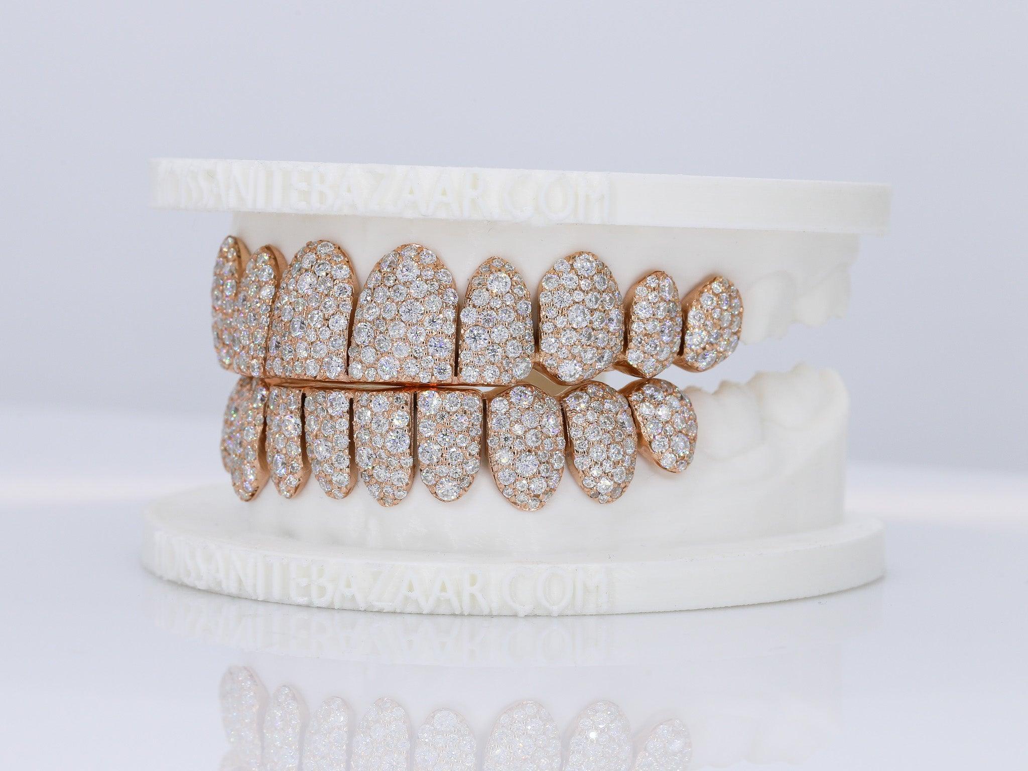 2048x1536 Mosaic Snow VVS Moissanite Diamond Grillz