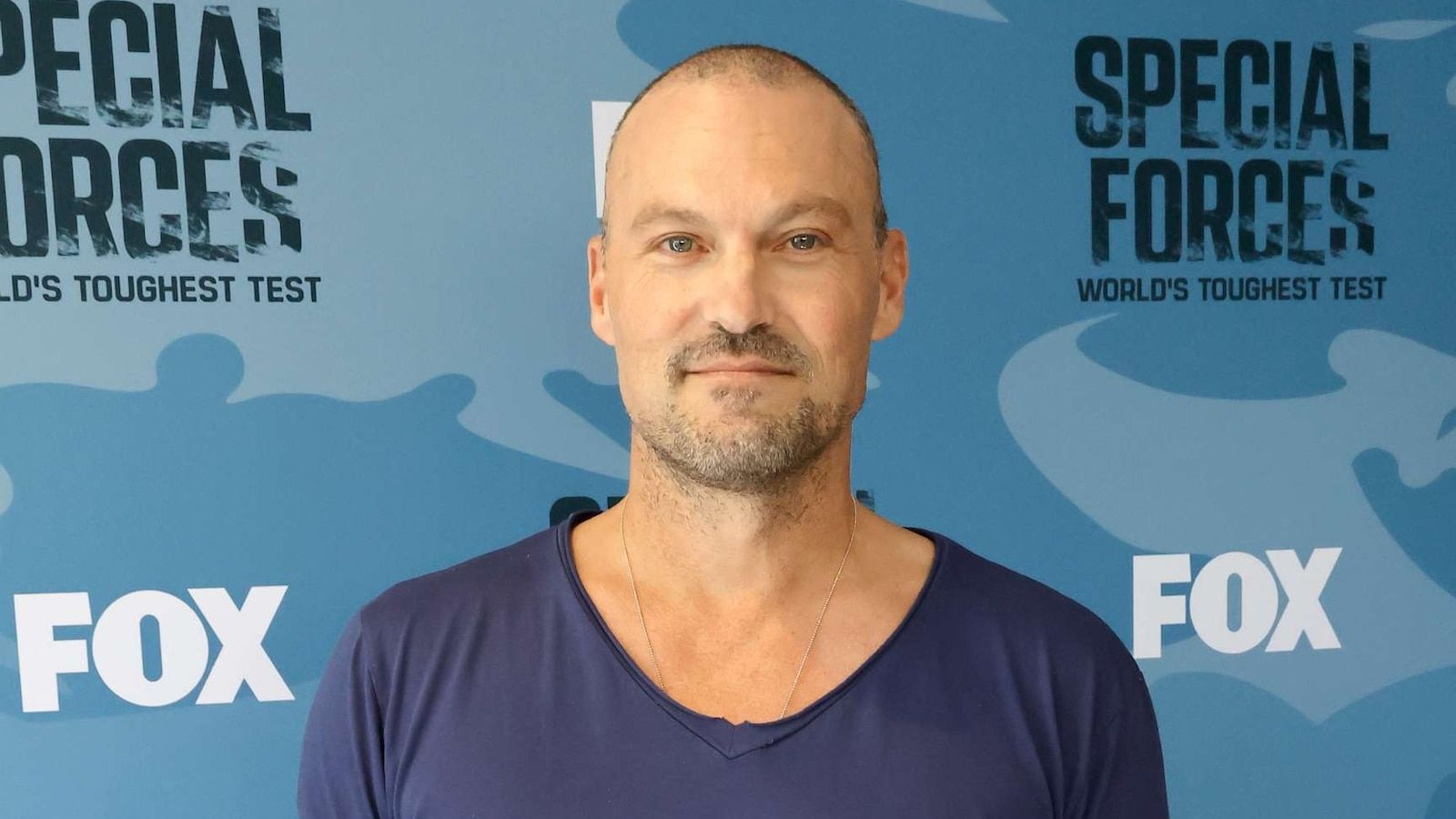 1600x900 Brian Austin Green opens up about health challenges: 'I couldn't walk'
