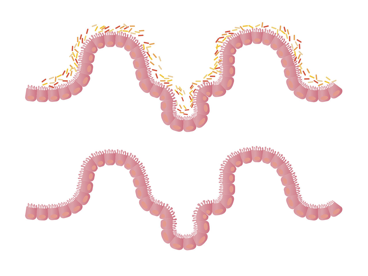 1280x960 Free Intestinal & Intestine Image