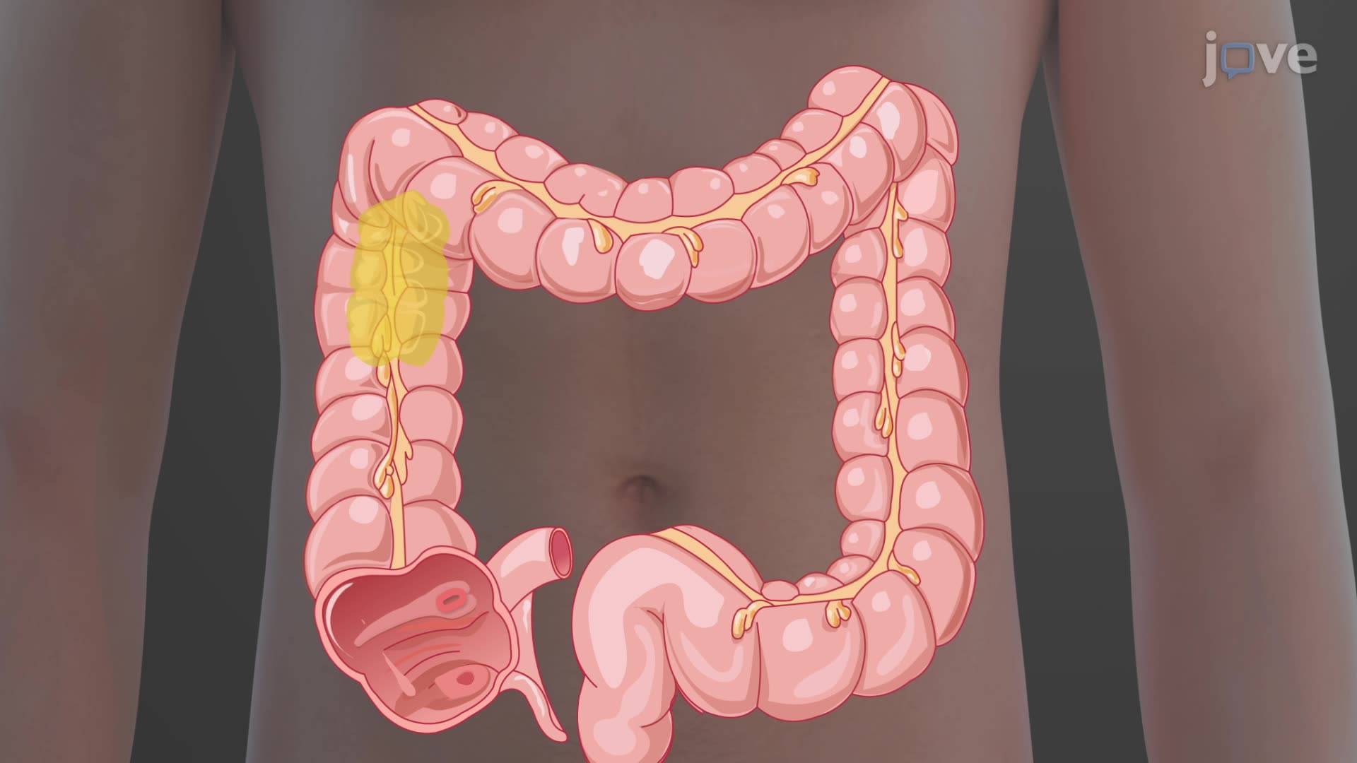 1920x1080 Digestive Functions of the Large Intestine in Anatomy and Physiology
