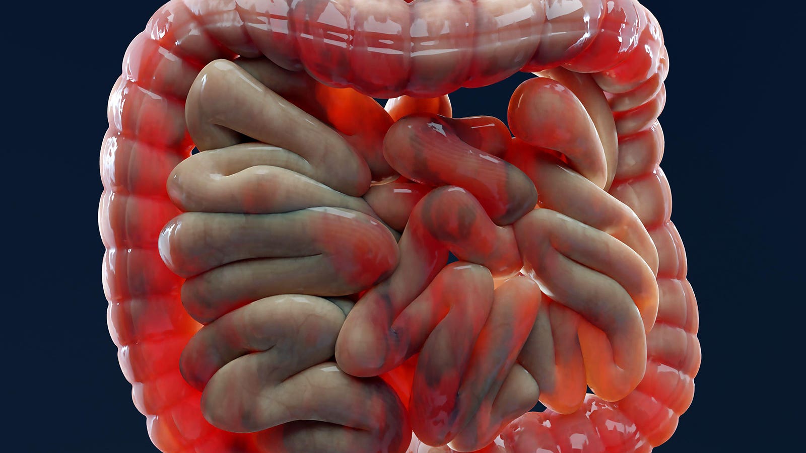 1600x900 Are NSAIDs Genuinely Too Dangerous in Inflammatory Bowel Disease?