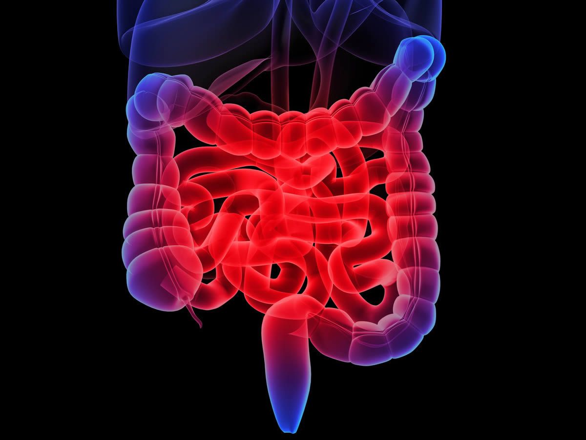 1200x900 Zonulin Levels Linked with Increased Intestinal Permeability for IBS