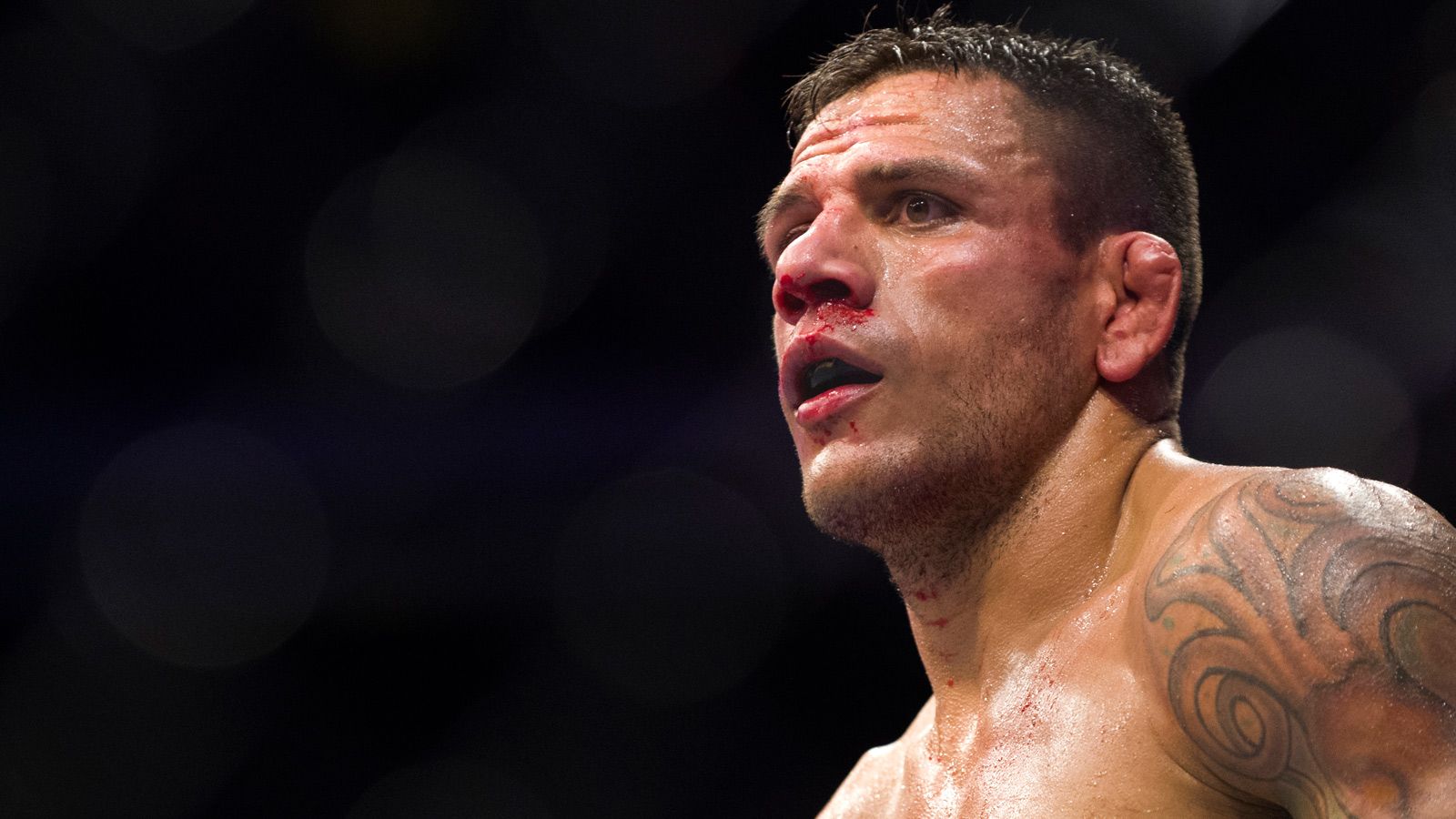 1600x900 Rafael dos Anjos avoids knee surgery but nose repairs require operation
