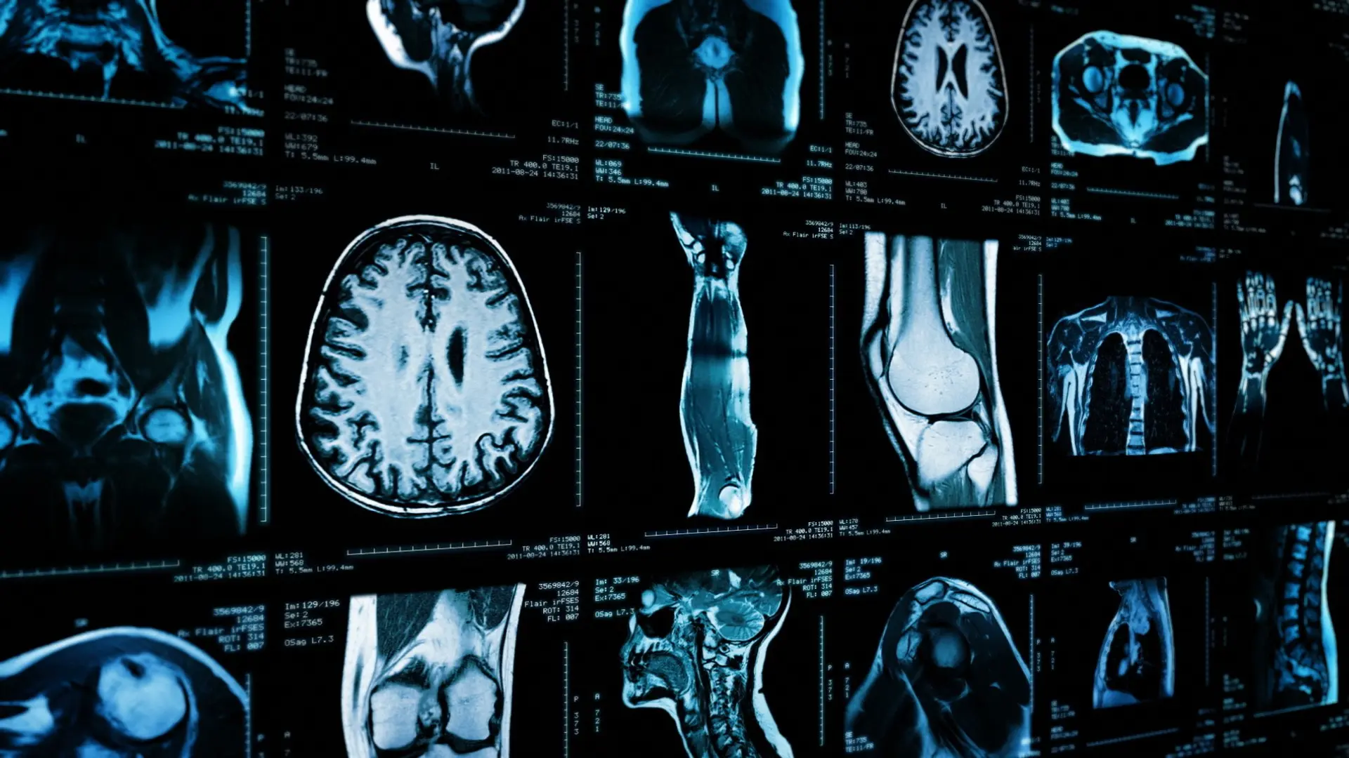 1920x1080 Clinical Divisions. Radiology and Imaging Sciences. IU School of Medicine