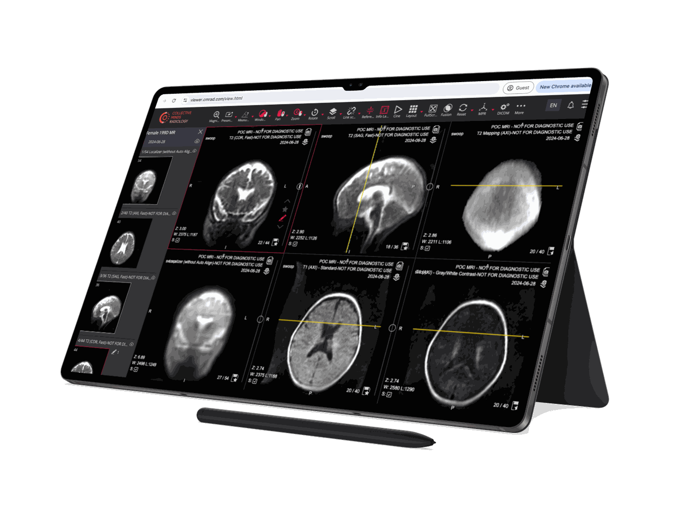 1400x1050 What Is DICOM? Understanding the Standard Powering Modern Medical Imaging