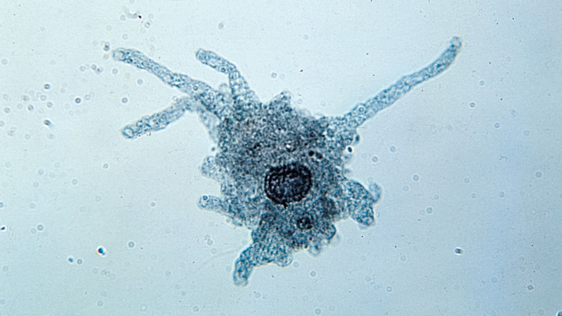 1920x1080 Amoeba. Protista, Unicellular & Flagellates
