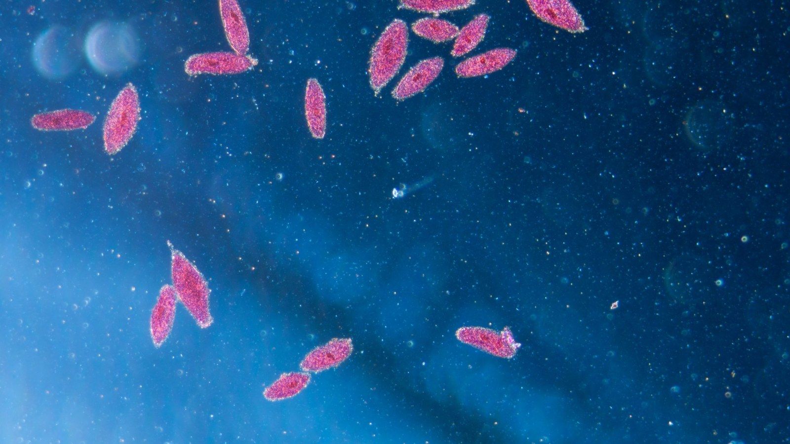 1600x900 How A Simple Amoeba Helped Scientists Better Understand The Complexities Of Alzheimer's