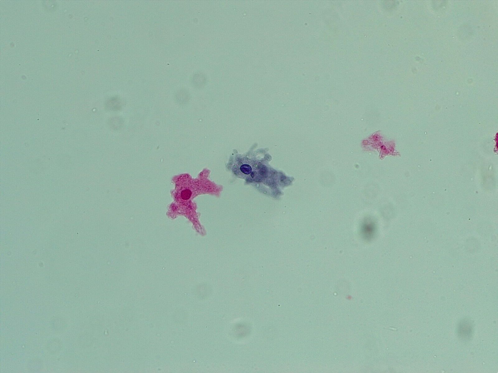 1600x1200 Amoeba