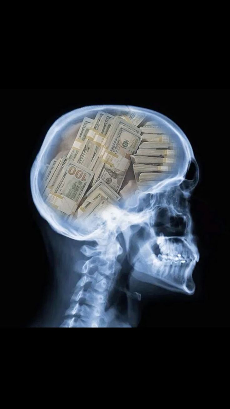 736x1308 My mind doesn't want stop thinking in money