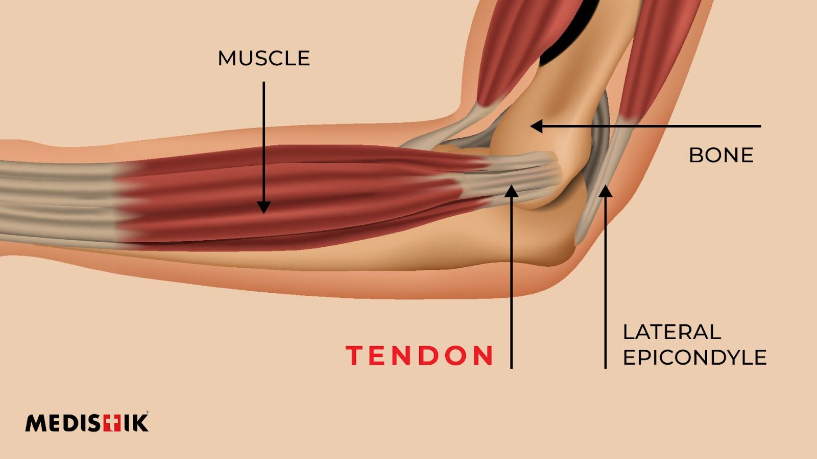 1600x900 Inner ForeArm Pain Relief Why Does My Forearm Hurt? Causes, Symptoms Treatment