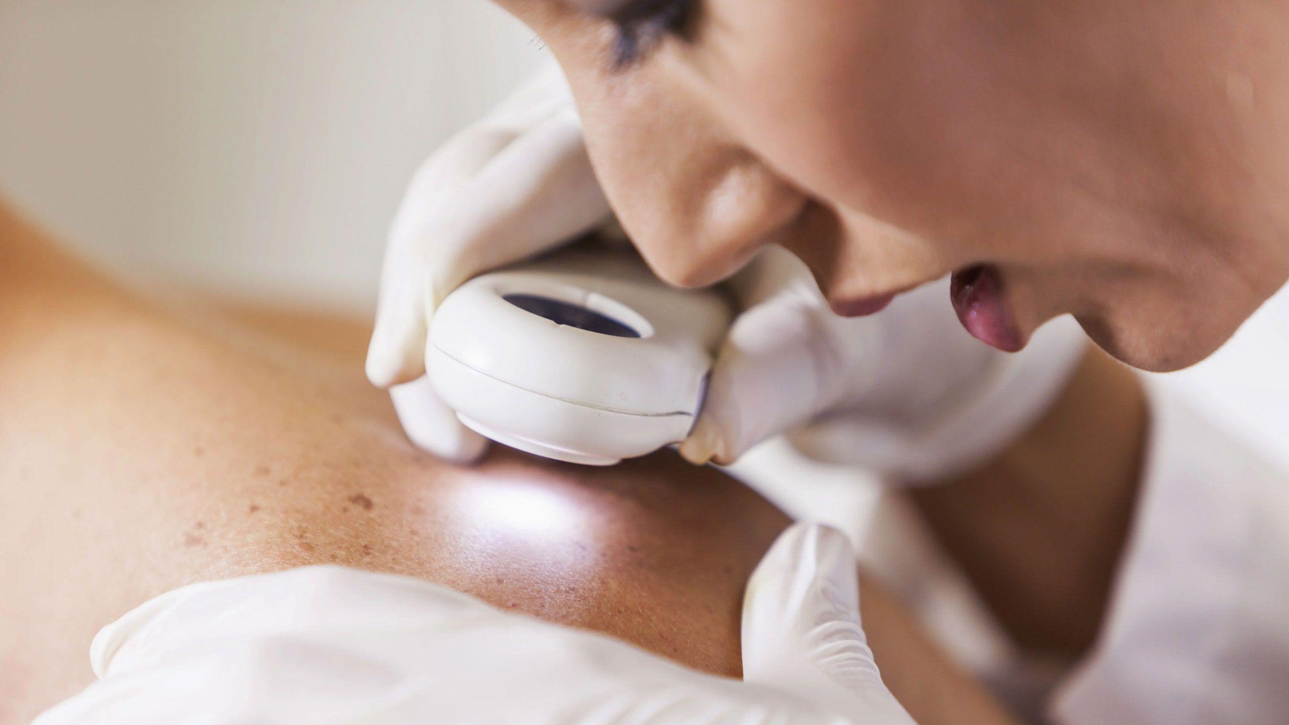 2560x1440 How to Treat Hyperpigmentation at the Dermatologist