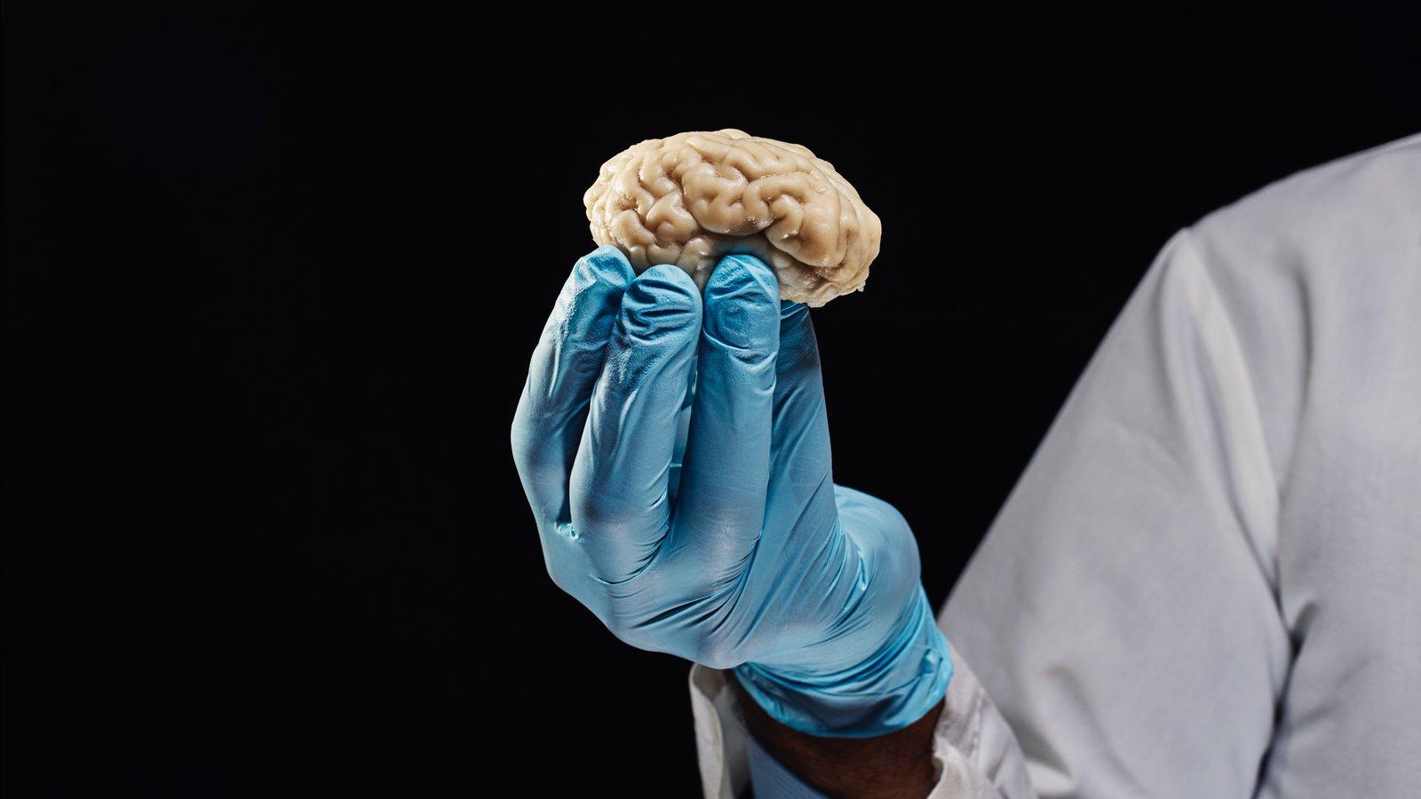 1600x900 Scientists Are Giving Dead Brains New Life. What Could Go Wrong?