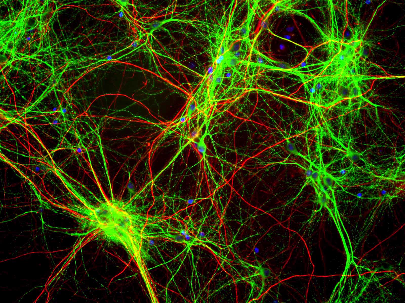1600x1200 Neuroscientists Have a New Algorithm for Simplifying the Brain's Deep Complexity