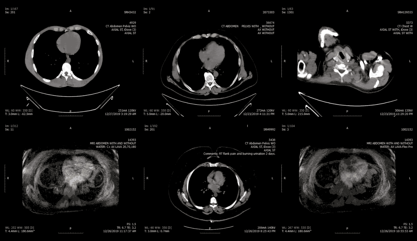 1400x808 A billion medical image are exposed online, as doctors ignore warnings