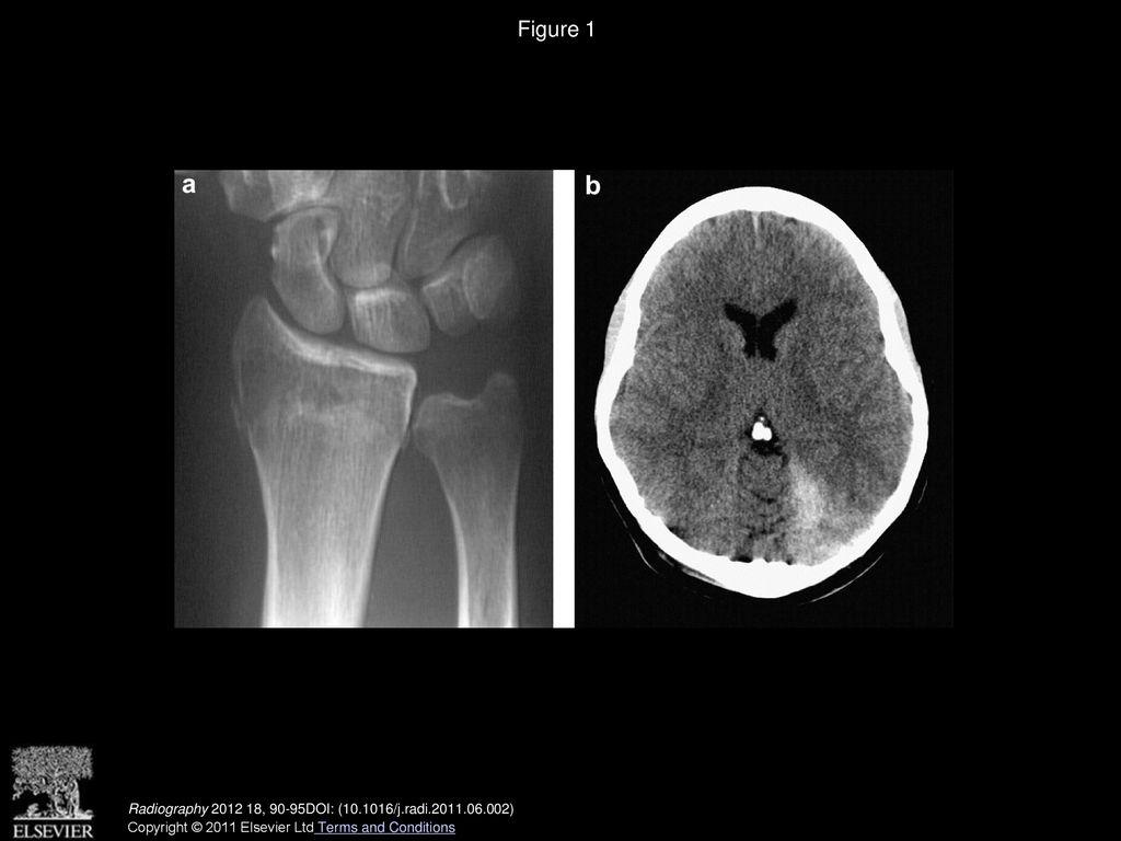 1024x768 Collaboration between radiological technologists (radiographers) and junior doctors during image interpretation improves the accuracy of diagnostic decisions