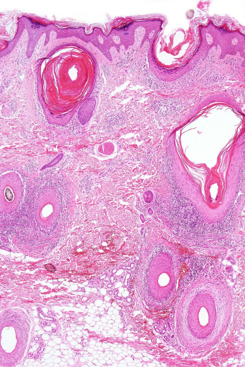 Histology Wallpapers - Top Free Histology Backgrounds - Wallpaperaccess