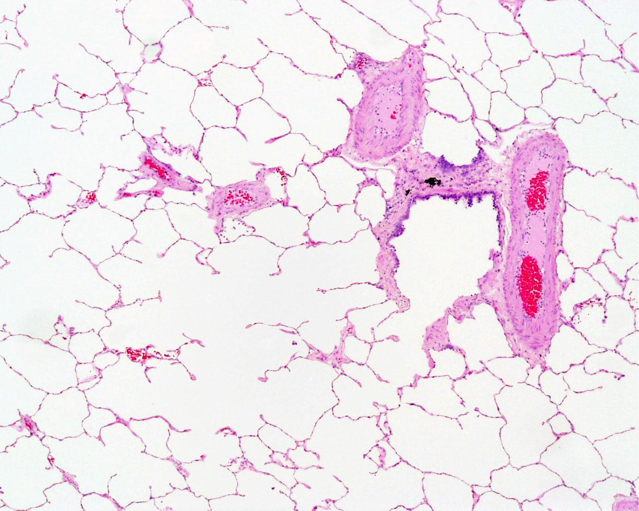 Легкое препарат. Легкое Гиста. Respiratory System lung Histology.