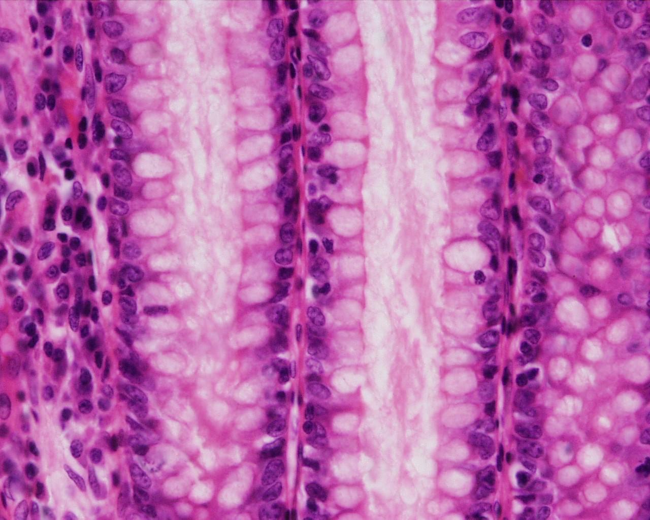 1280x1024 Colon histology