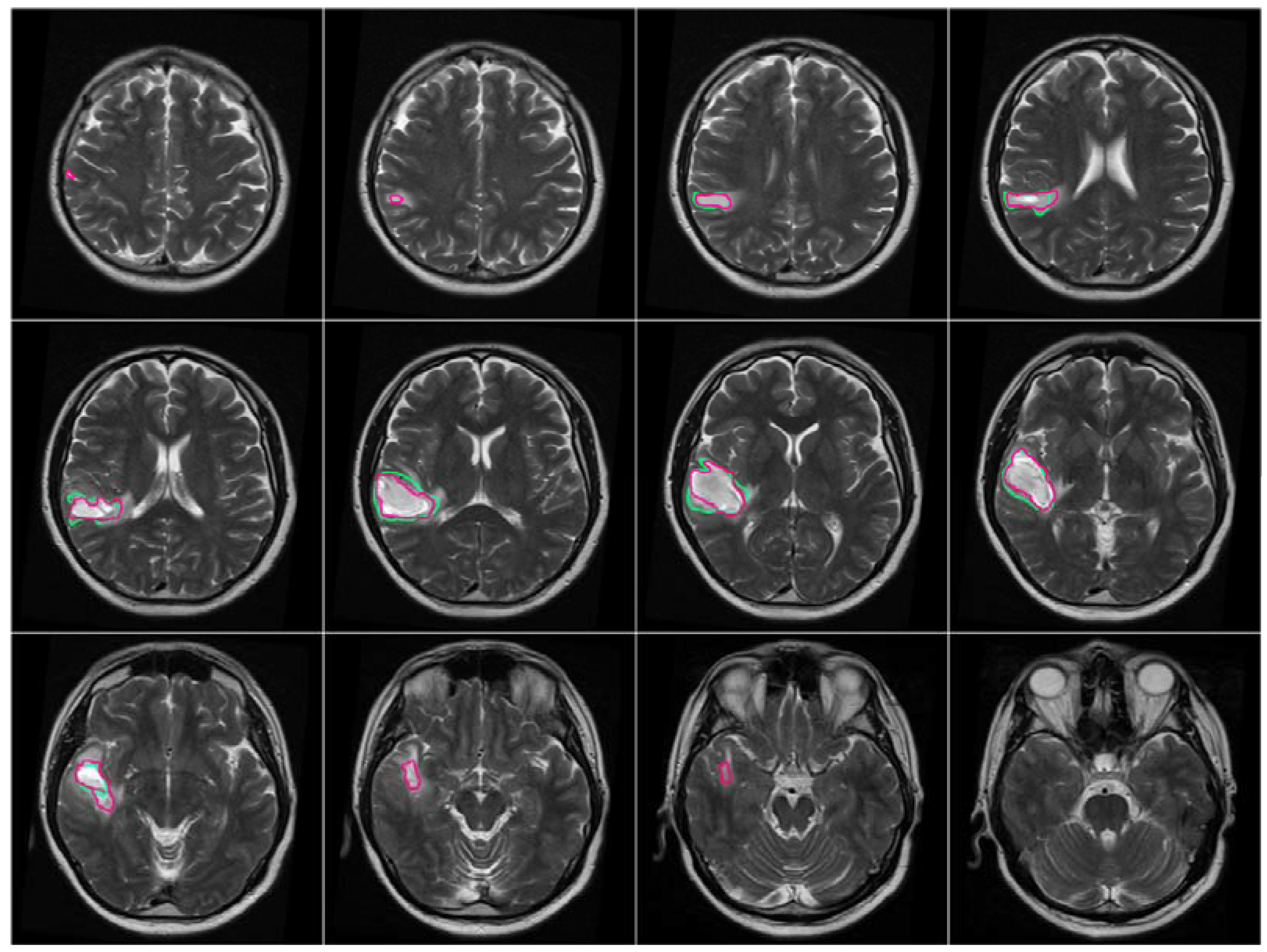 mri-wallpapers-top-free-mri-backgrounds-wallpaperaccess