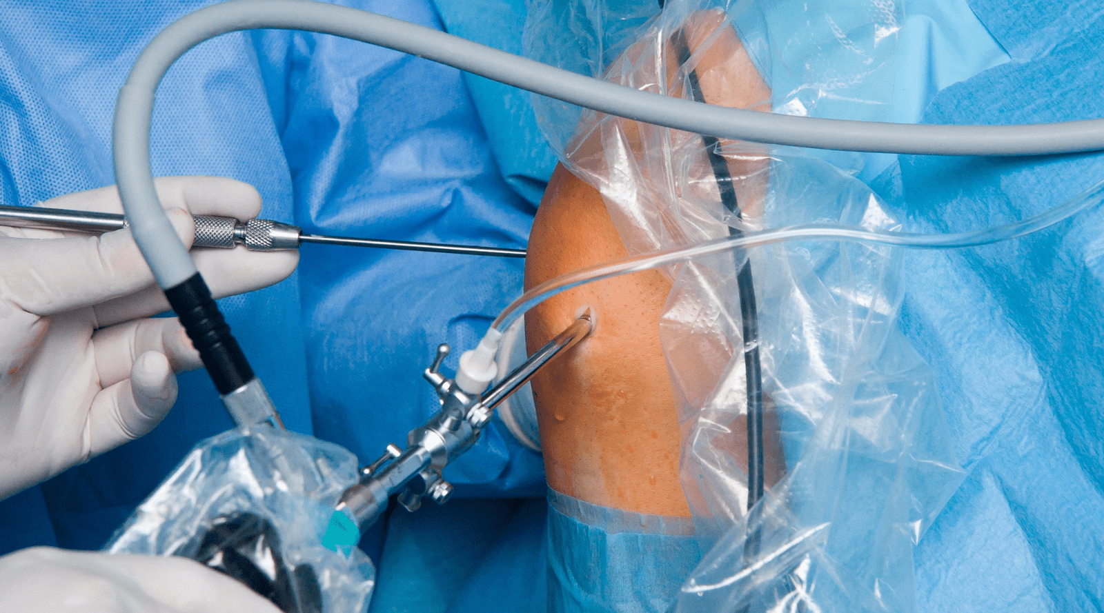 1600x889 UPDATED List of Orthopedic Blogs and Sites For Guest Posting