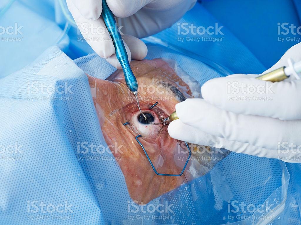 1024x768 Eye Surgery Closeup Surgeon HD Wallpaper
