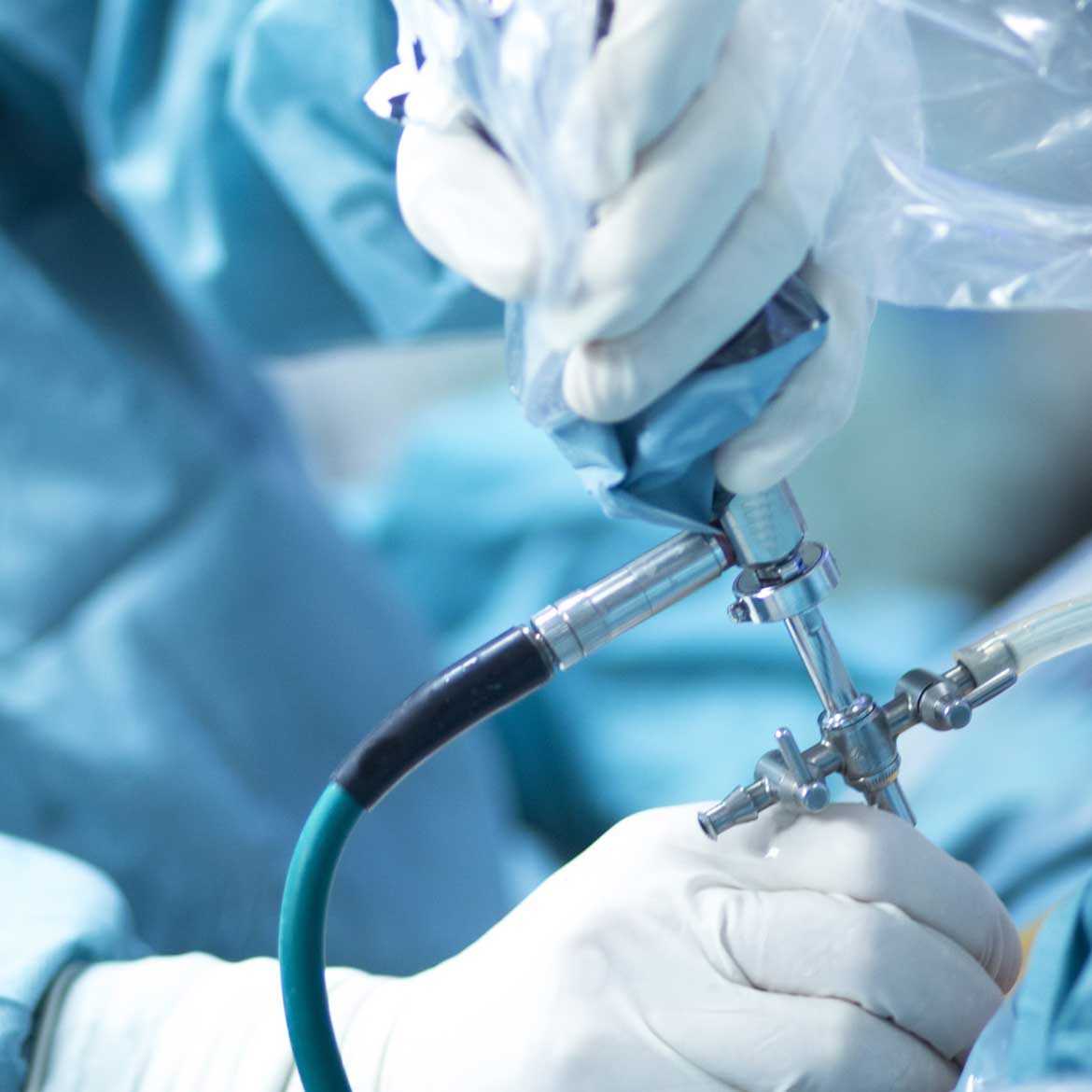 1170x1170 Arthroscopic Surgery The Villages. Advanced Orthopedics Institute