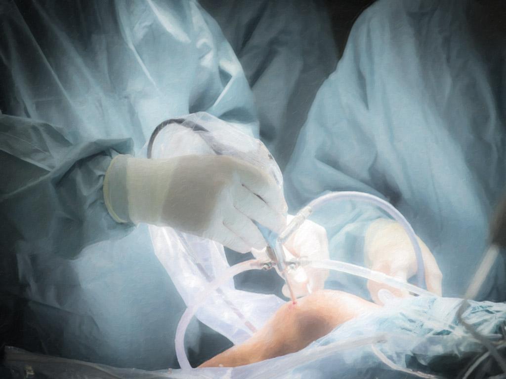 1024x768 Arthroscopic Knee and Ankle Surgery Specialty Care in Ocala, FL