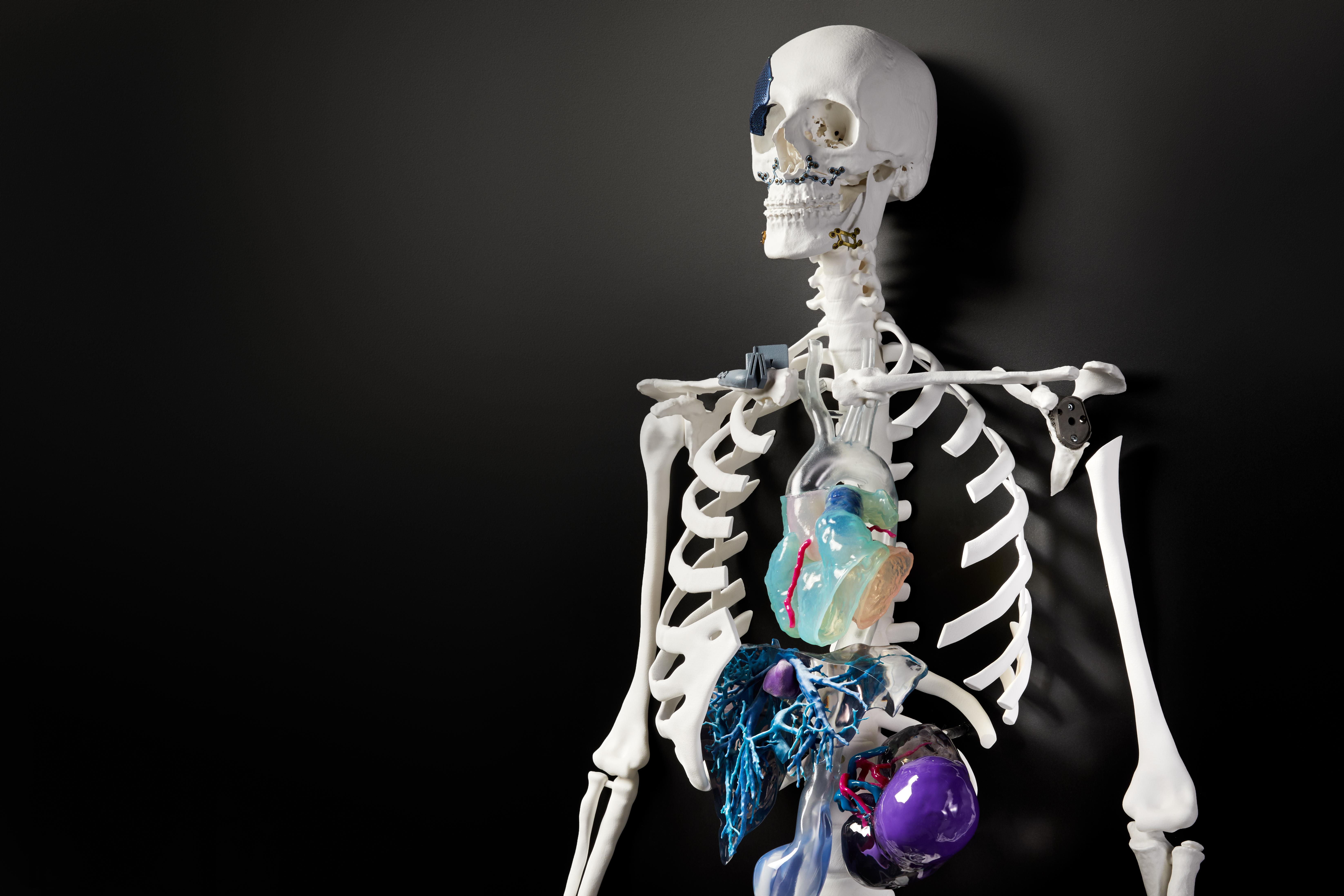 6582x4388 Fit To Print: The Future Of Orthopedic Surgery Will Come Out Of A 3D Printer. Medical Design and Outsourcing