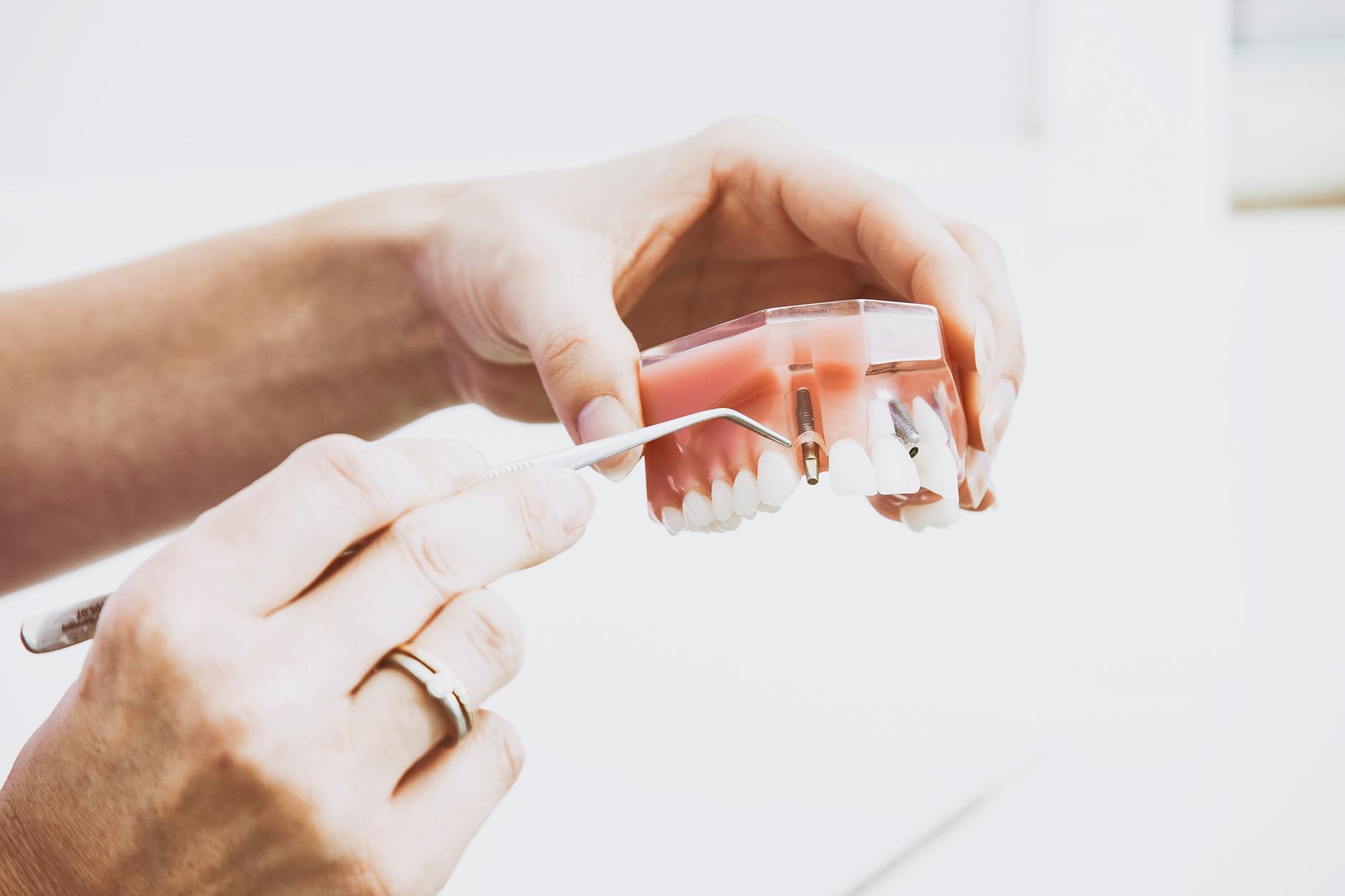 1875x1250 Paul Hall D.D.S. Inc., Oral Surgeons, Maxillofacial Surgeons, Daly City CA