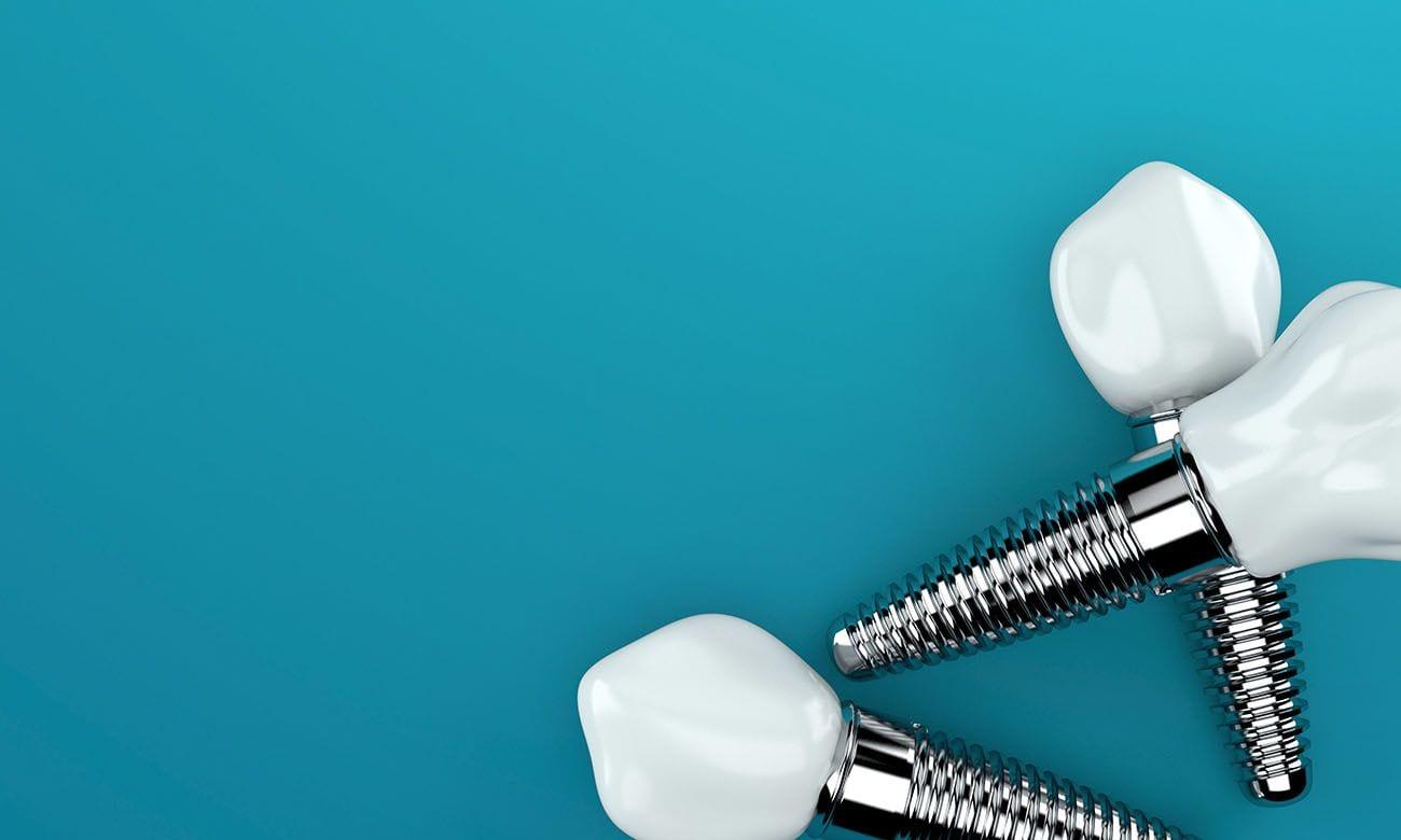 1300x780 Dentures or Dental Implants?. Dentist in Peachtree City, GA