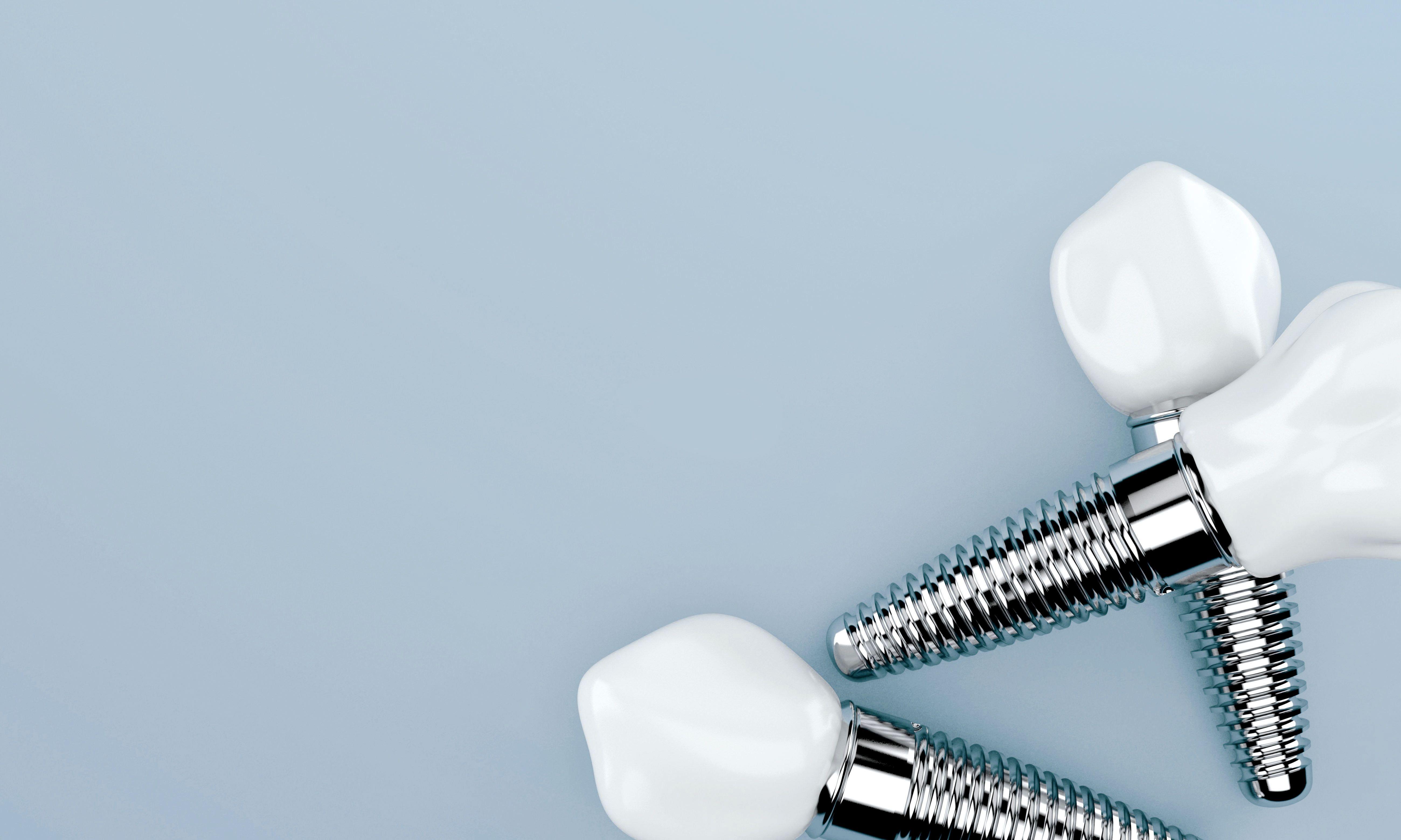 Lush Best Place To Get Dental Implants Wallpaper Photography Lush Best Place To Get Dental Implants Wallpaper Photography