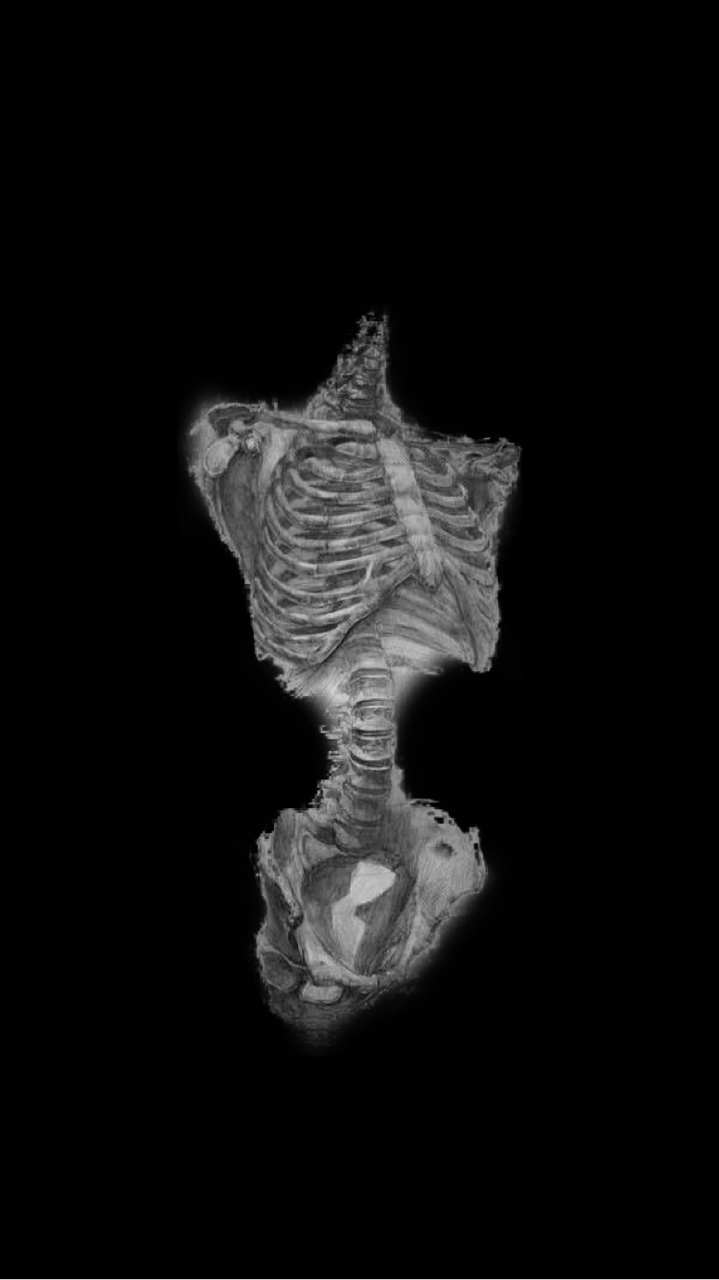 719x1280 skeleton aesthetic background