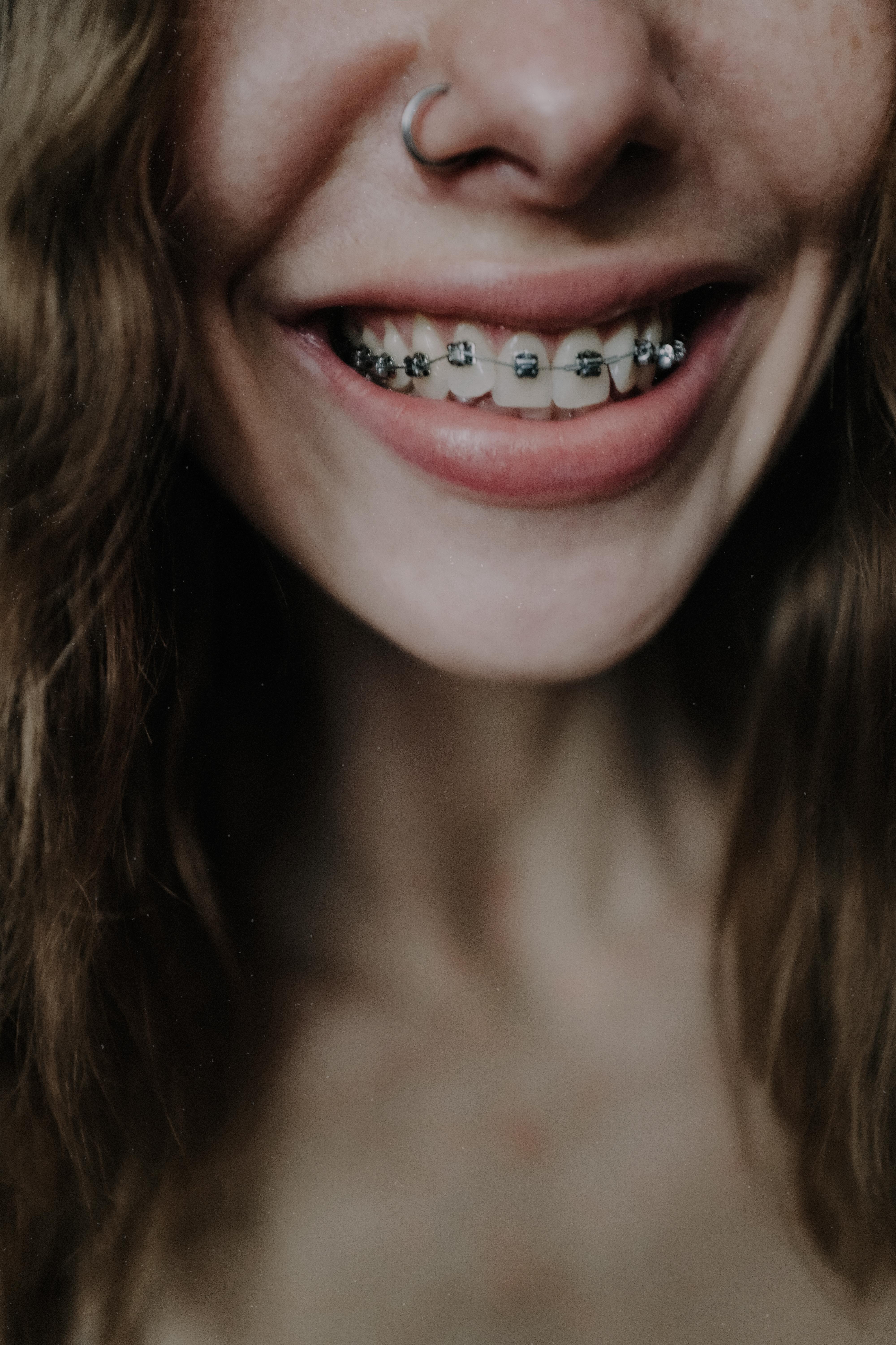 4000x6000 Crop woman smiling and demonstrating teeth braces · Free
