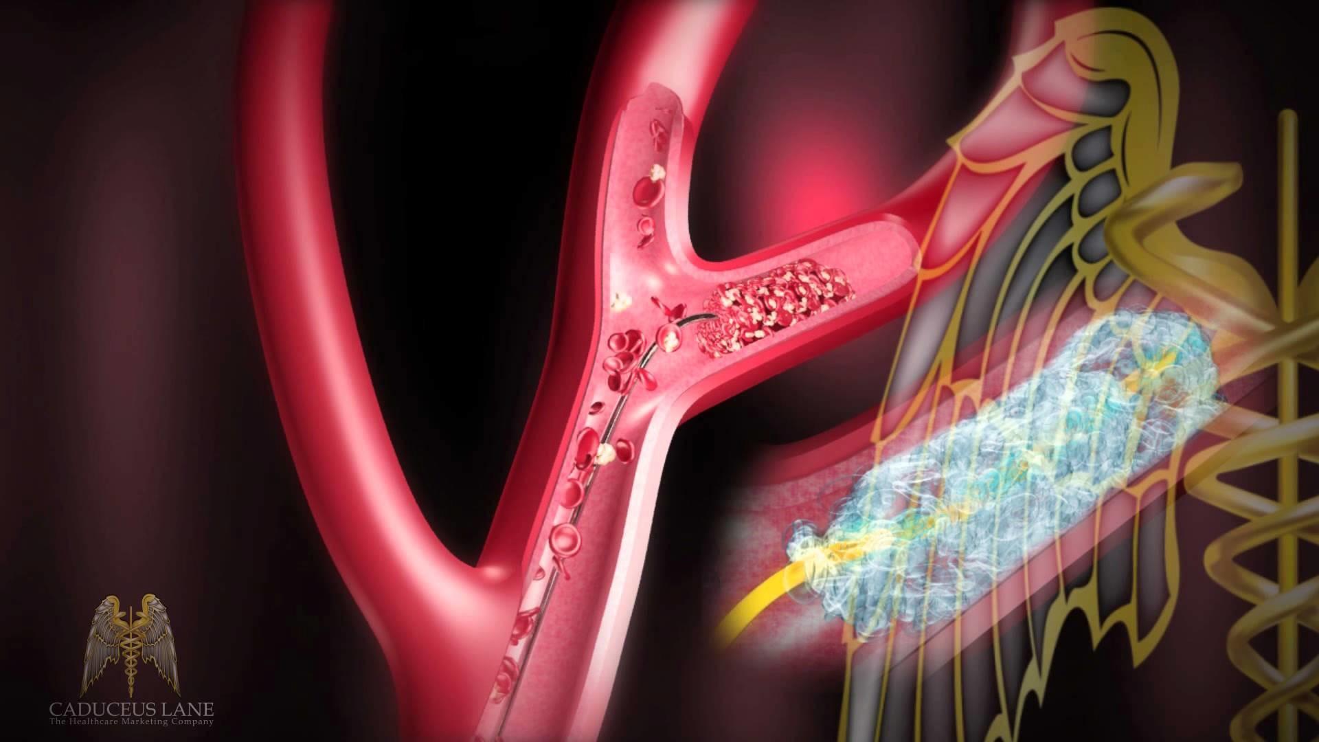 1920x1080 HD Medical