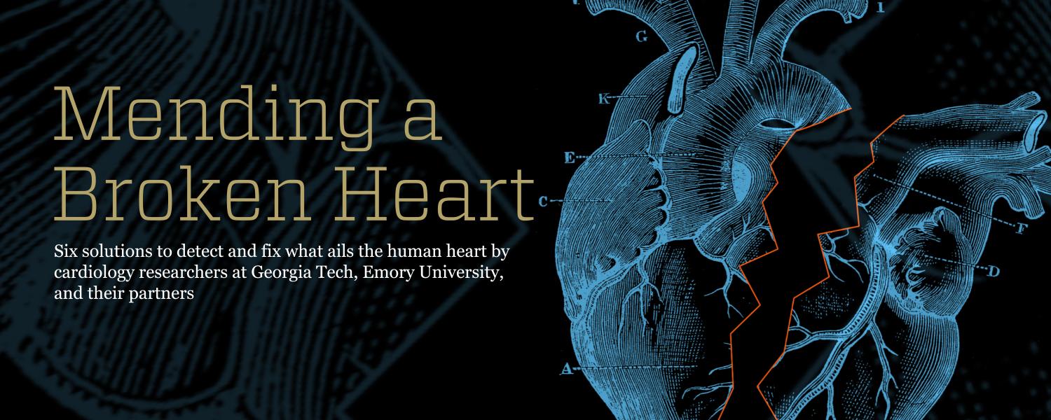 1500x600 Mending a Broken Heart. Research Horizons. Georgia Tech's Research News