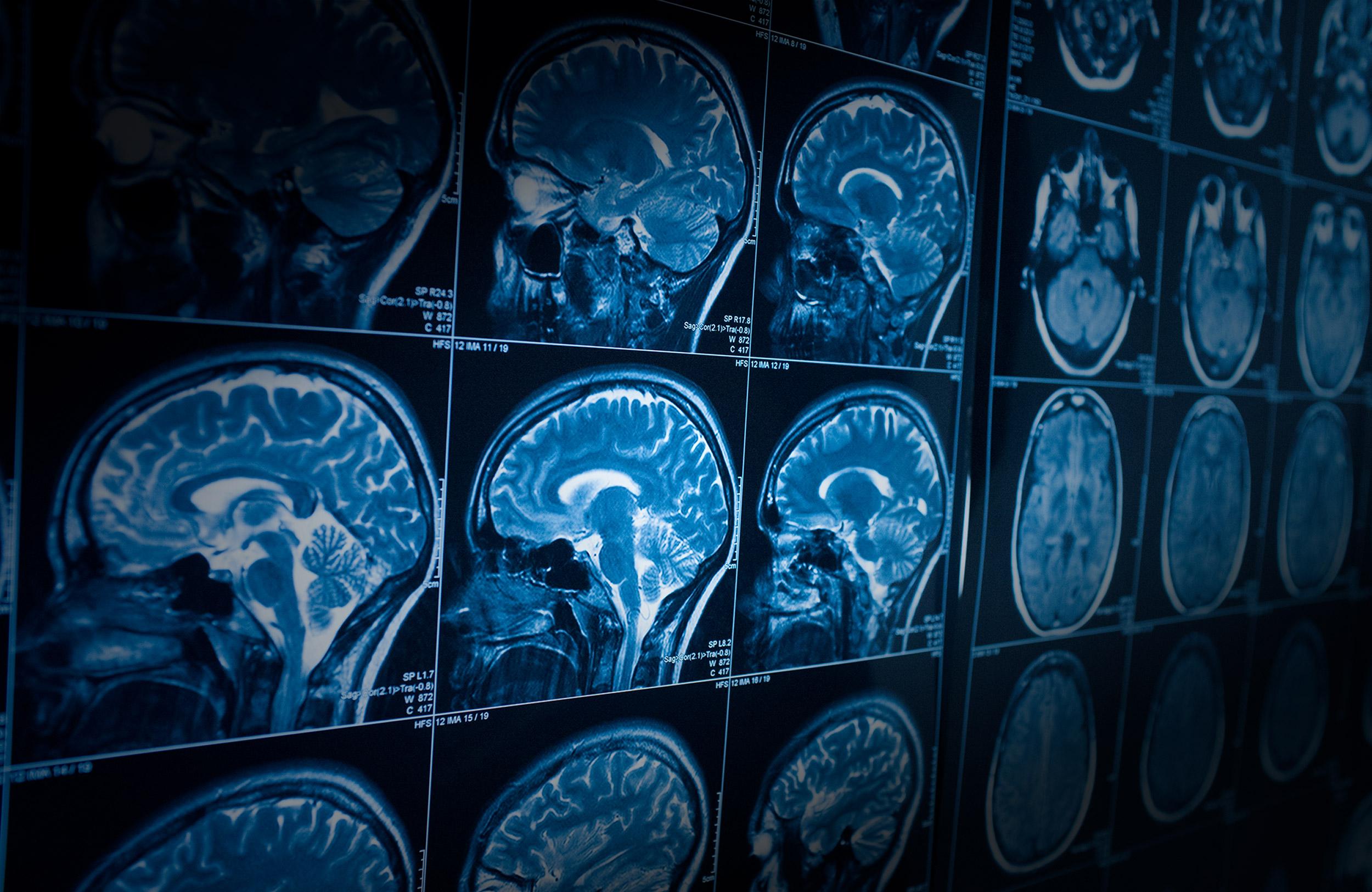 Neurological Wallpapers Top Free Neurological Backgrounds Neurological Wallpapers Top Free Neurological Backgrounds