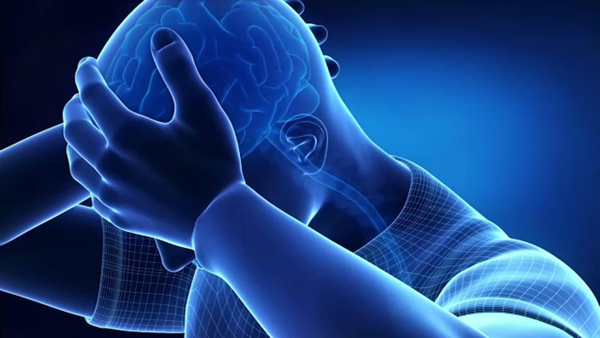 Serene Why Do I Get A Headache Capture Illustration Serene Why Do I Get A Headache Capture Illustration