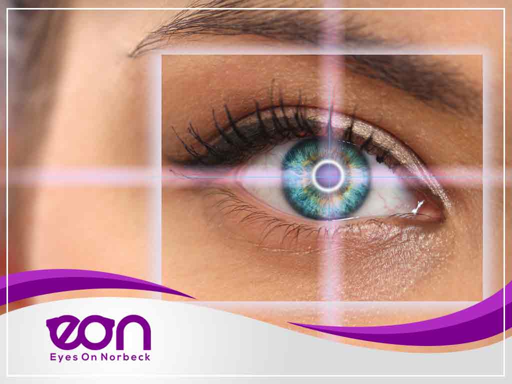 1024x768 Common LASIK Surgery Myths and the Truth Behind Them