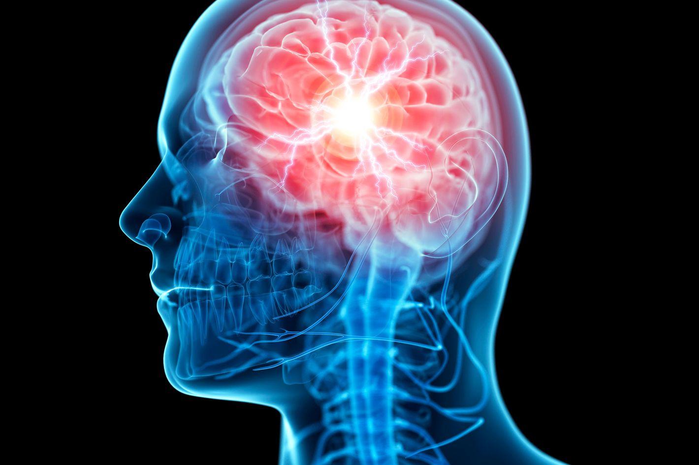 1420x946 The Brain Meme Will Expand Your Mind