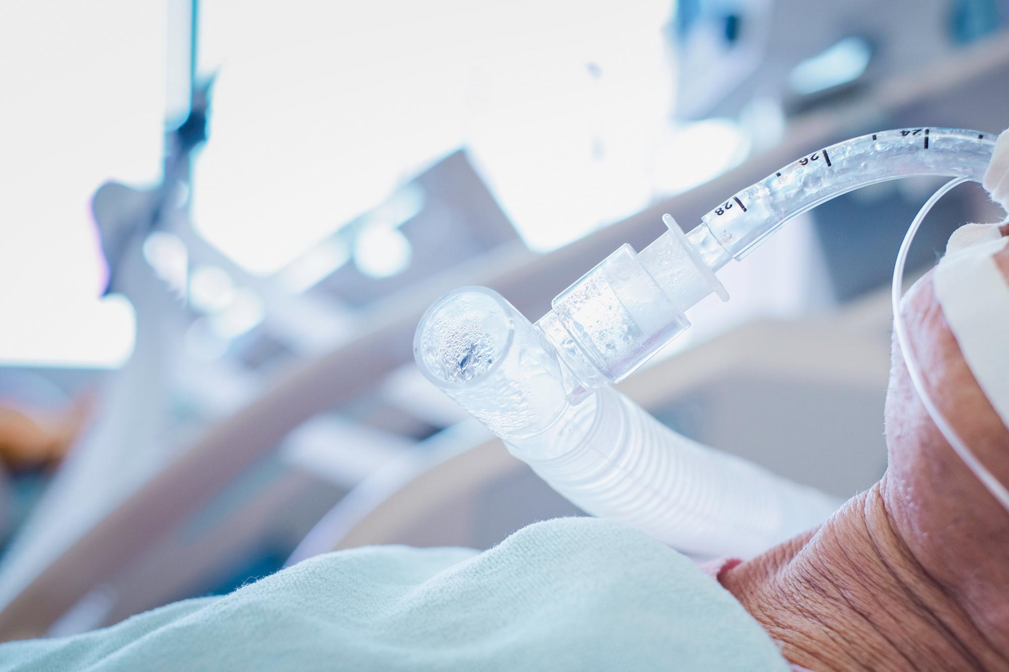 2000x1332 Majority Of Coronavirus Patients Put On Ventilators Don't Survive : Shots