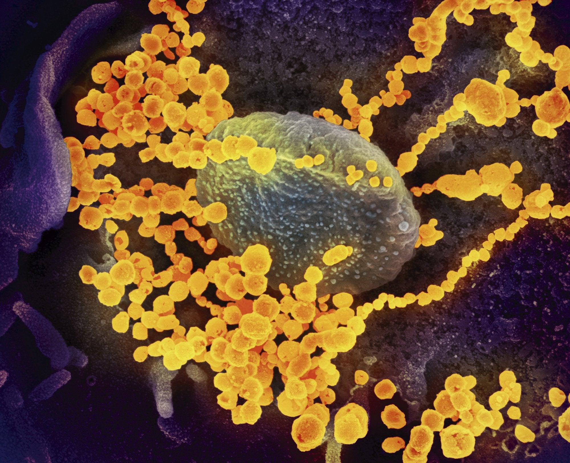 2000x1622 Your very own coronavirus wallpaper, from the CDC Public Health Image Library