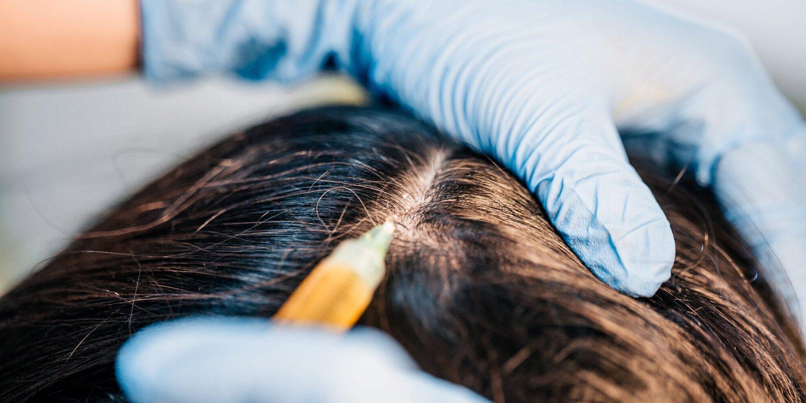 1600x800 How Can I Restore My Scalp Health?, Glendale AZ