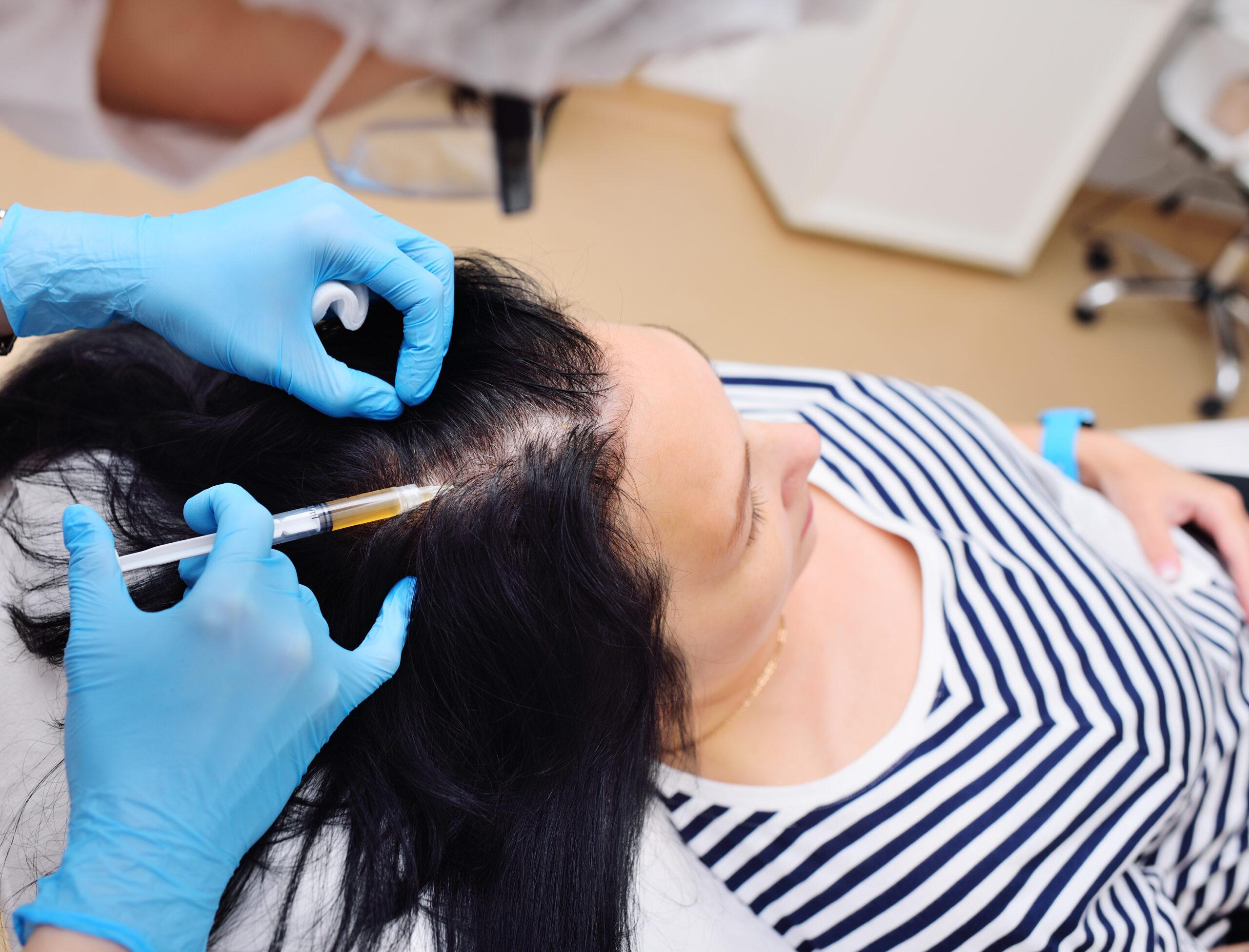 2560x1952 Is Natural Growth Factor Injections Hair Restoration Effective? Laser & Med Spa