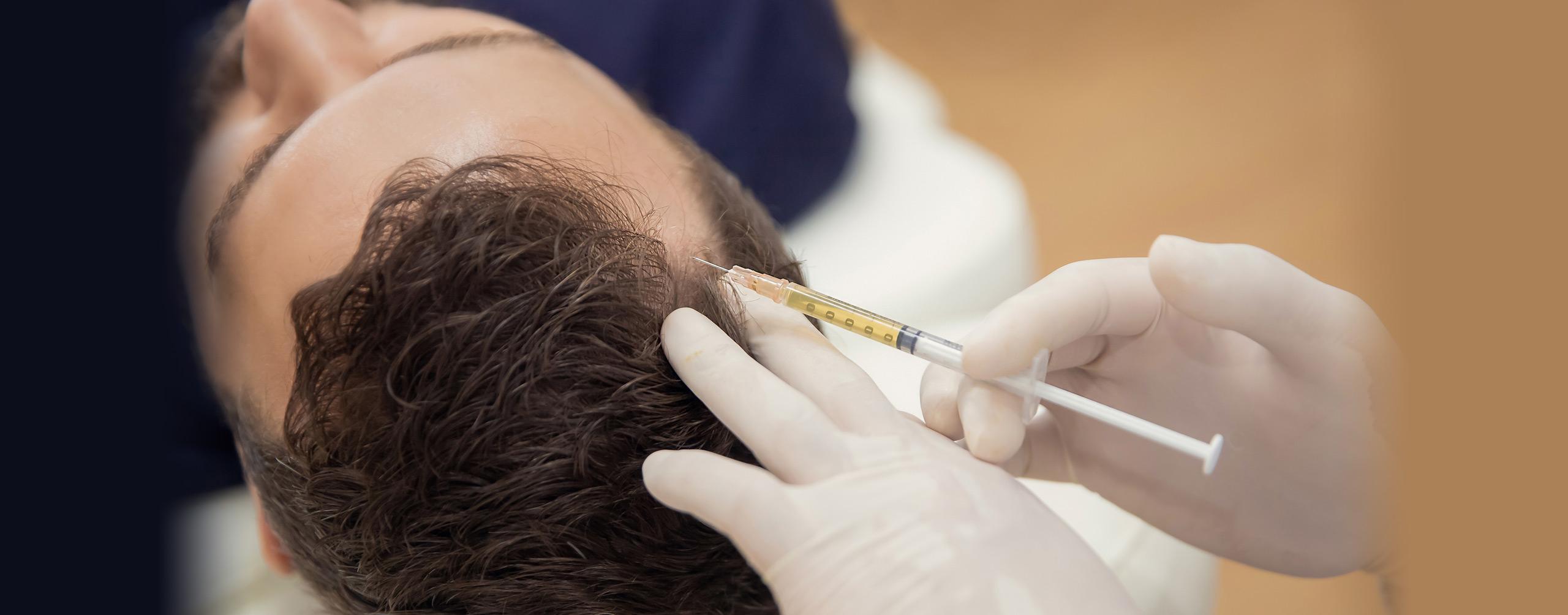 2560x1004 Hair Restoration Acton. PRP Hair Treatment Boston